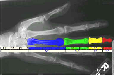 Datei:fib hand.jpg